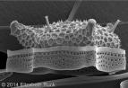 diatom